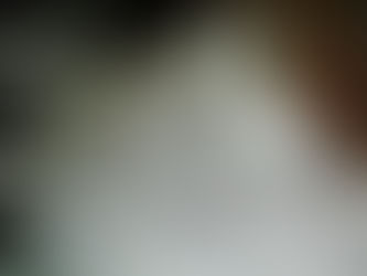 Fáscia: o tecido que pode estar mantendo sua dor e inflamação