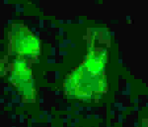 11_NG-DTG-P58_EAR_SOX9_40x_cropped