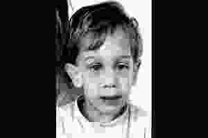 fragile-X-syndrome