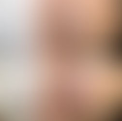 HBLビフォーアフター