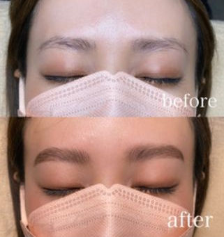 HBLビフォーアフター