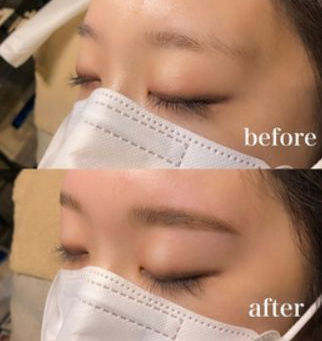 HBLビフォーアフター