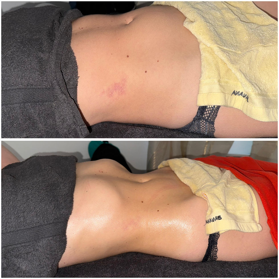 Avant / Après de drainage lymphatique