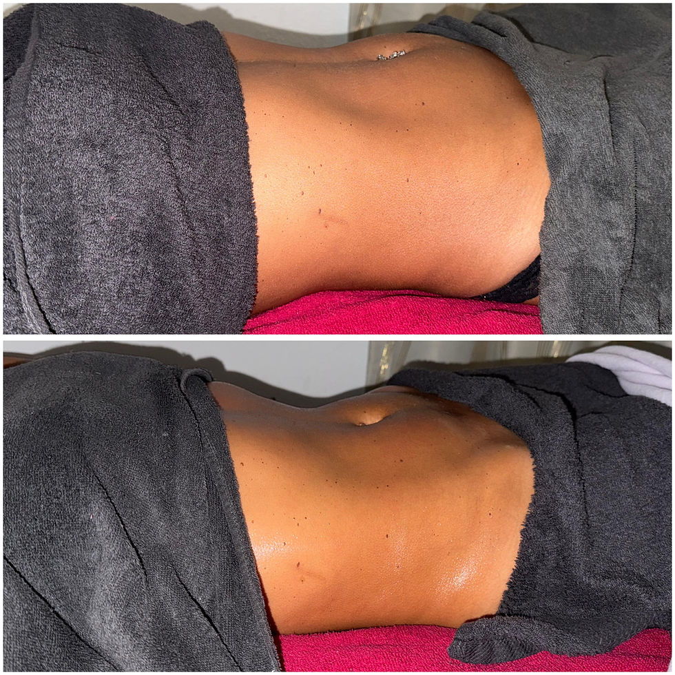 Exemple d'avant – après avec la technique de Drainage Lympathique by Roxane P.