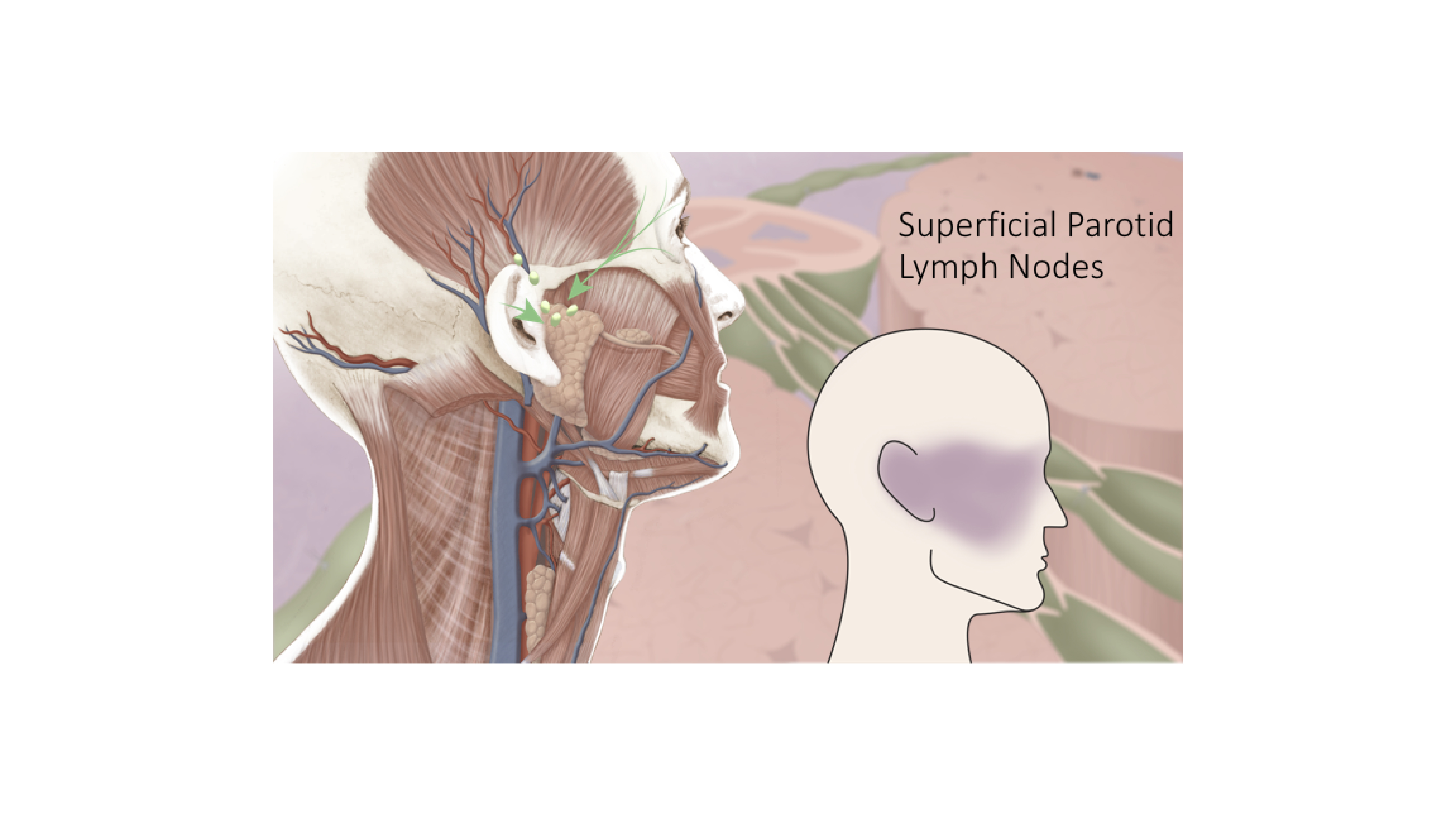 Lymph Nodes Powerpoint