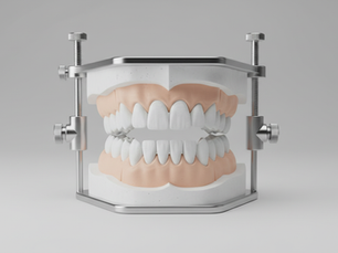 Orthodontie d'abord ou chirurgie d'abord : décider de la séquence pour l'alignement des mâchoires