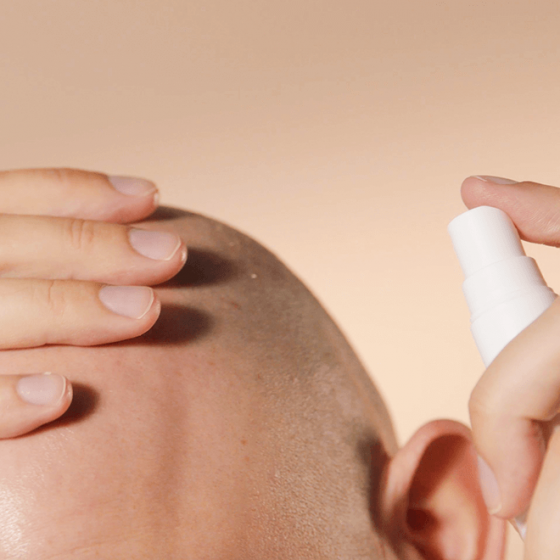 alopecie-brume-cuir-chevelu (2)