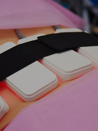 Non surgical body sculpting. body contouring