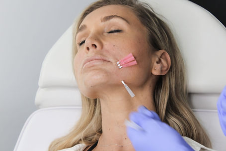 pdo-threads-lips-body-sculpting-clinics-6-web.jpeg