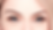 Lower Eyelid Entropion lower eyelid outward laxity