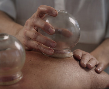 ventouses - cupping