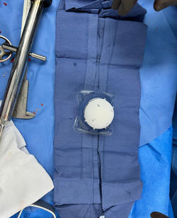 Reemplazo articular