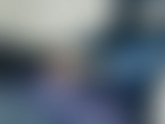 Cirugía de catarata después de LASIK: ¿por qué el cálculo del lente requiere mayor precisión?