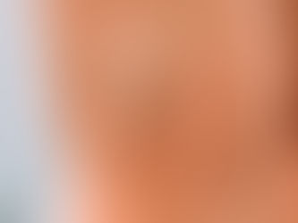 Factores que aumentan el riesgo de várices