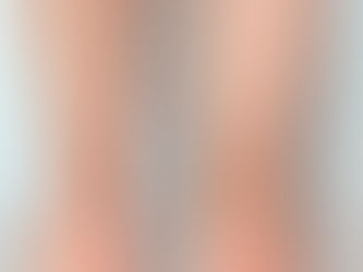 ¿Qué es la Angiología y Cirugía Vascular?