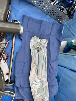 Reemplazo articular