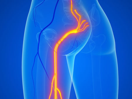Dolor que baja por la pierna: ¿Es ciática? Aprende a identificarla y aliviarla a tiempo