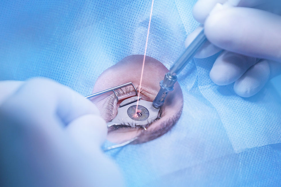 Riesgos y beneficios reales del LASIK: todo lo que debes saber antes de la cirugía