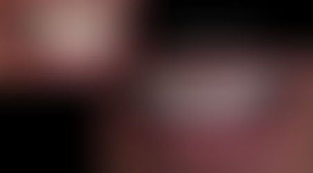 sorriso protocolo Dr Douglas Lima