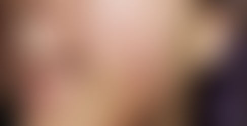 Làm thế nào để phục hồi da bị kích ứng?