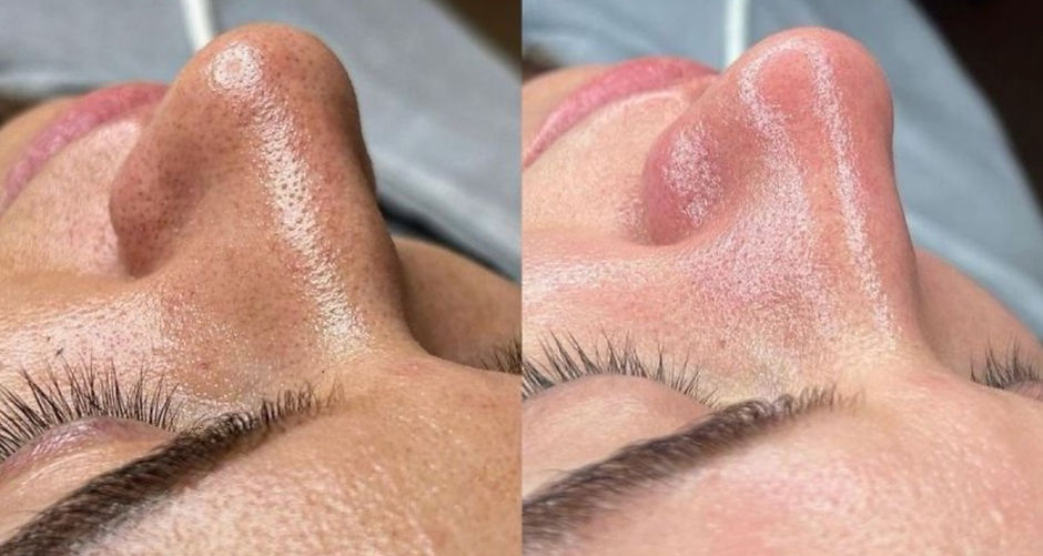 facial treatment Skintastic Nutley NJ 