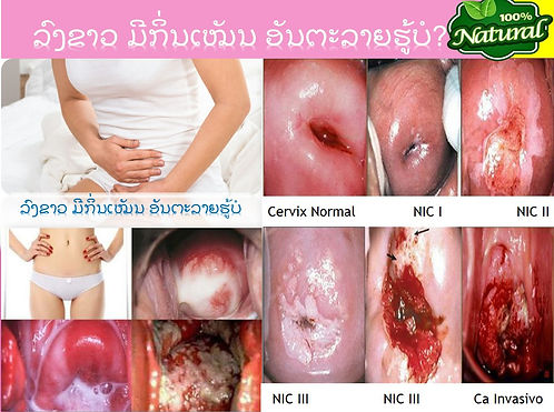 Slide22.JPG