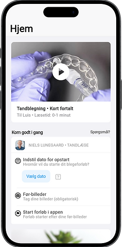 adent-whitening-mobile-video-and-start.png