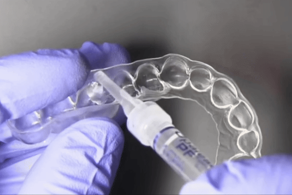 apply-whitening-gel-to-tray.gif