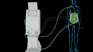 Research Spotlight: Why the “Heat” in HIPEC Matters — And What It Means for Patients