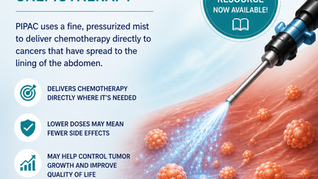 Medical poster for PIPAC chemotherapy by Abdominal Cancers Alliance, showing a catheter spraying treatment toward abdominal tumors.