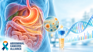 Molecular Testing May Offer a New Way to Improve Staging of Gastric Cancer