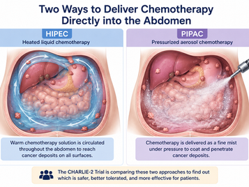 Comparing Two Ways to Deliver Chemotherapy Directly into the Abdomen for Peritoneal Cancer Spread (CHARLIE-2 Trial) HIPEC vs PIPAC