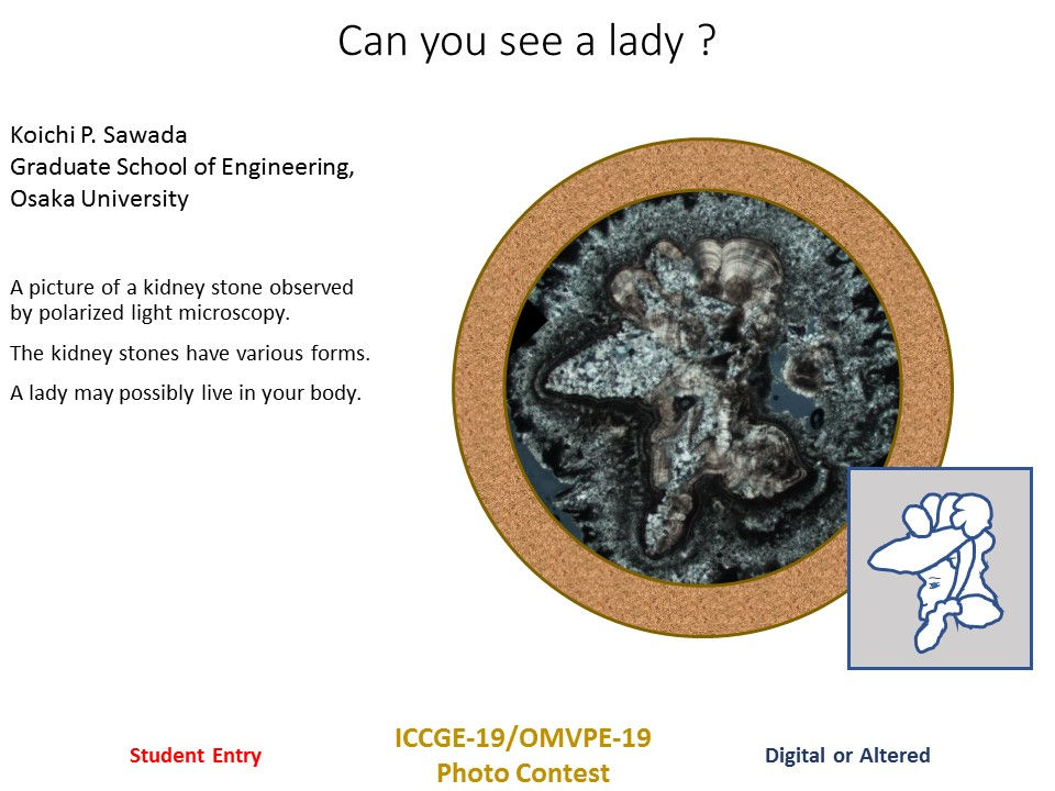 Dr. Koichi Sawada: 1st place (student category)