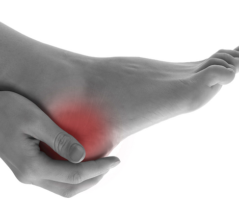 Heel pain cropped.png