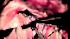 Sylvius静脈のどこを分けるか