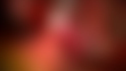 高齢者の方が三叉神経痛の手術成績が良い？