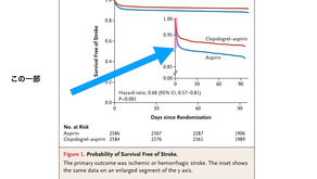 進行性脳卒中に対するバイパス手術(1)