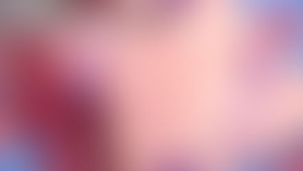 開頭範囲は骨にもマーキング