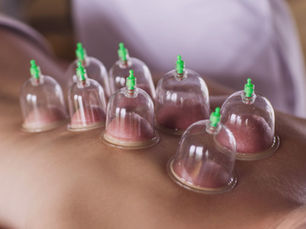 Cupping Questions Answered