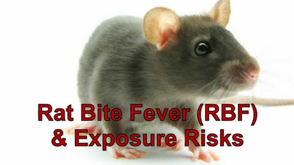 RAT BITE FEVER (RBF) & Exposure Risk!