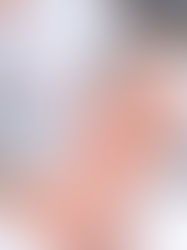 احصل على جمال طبيعي مع حقن الفيلر في أبو ظبي