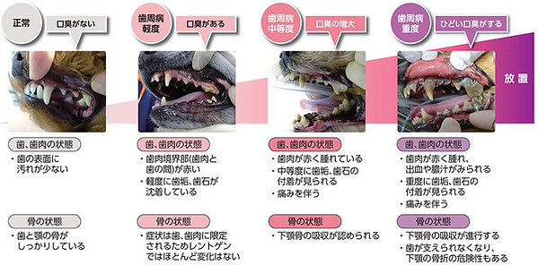 歯周病評価.png