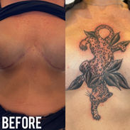 Fully Healed Keloid Scar Cover Up Leopard by Chris Clemence