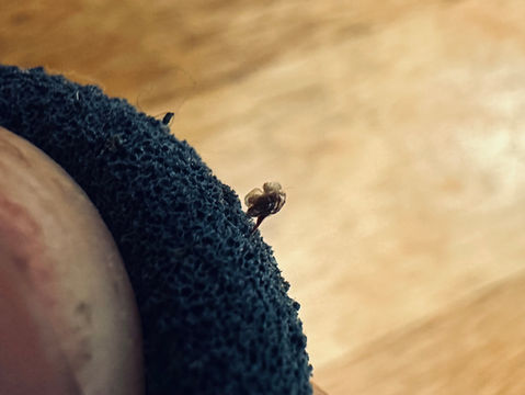 A bee sting.