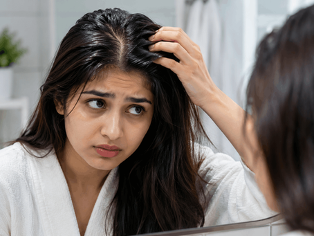 Can Oily Scalp Cause Hair Fall? The Complete Guide to Excess Oil, Dandruff, and Healthy Hair