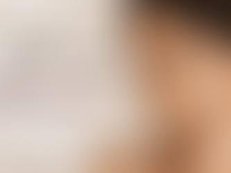 Common Mistakes That Make Hyperpigmentation Worse (And How to Avoid Them)