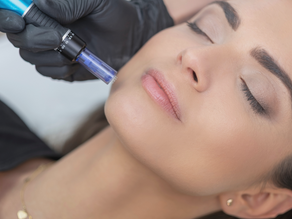 Micro-needling Treatment: esthetician is doing Micro-neediling