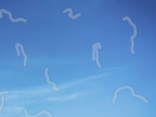 Flashes And Floaters: When Should You Worry?