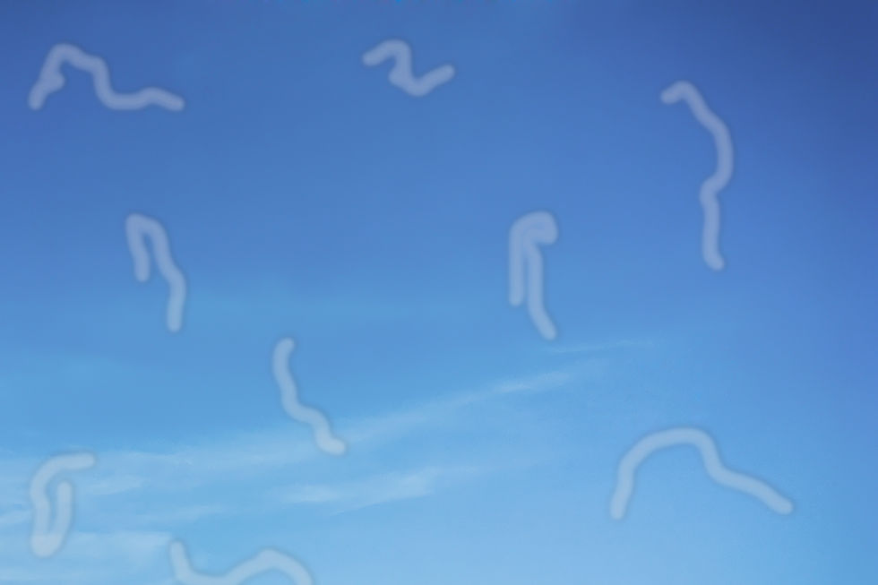 Flashes And Floaters: When Should You Worry?