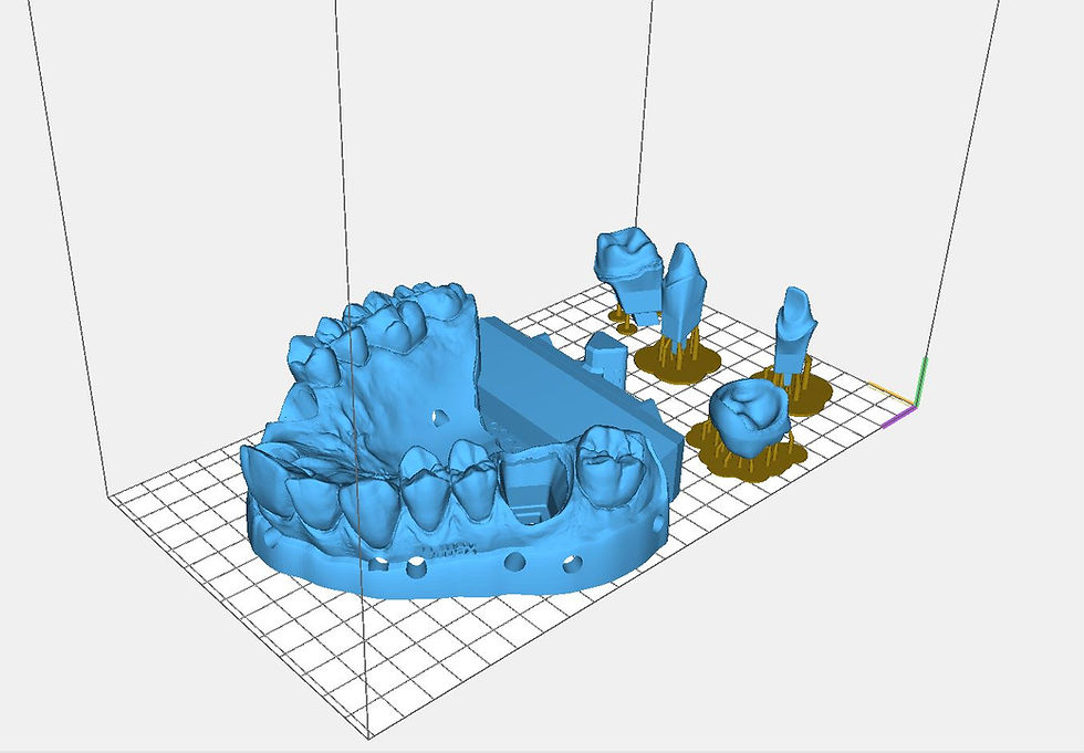 Digital workflow